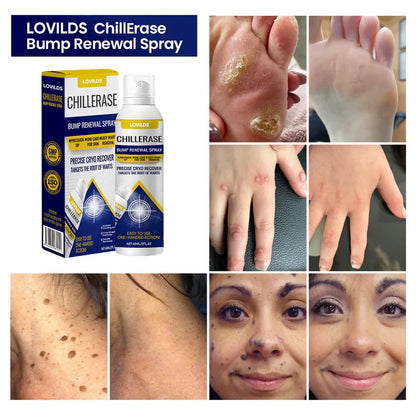 LOVILDS™ ChillErase Bump Renewal Spray🔥